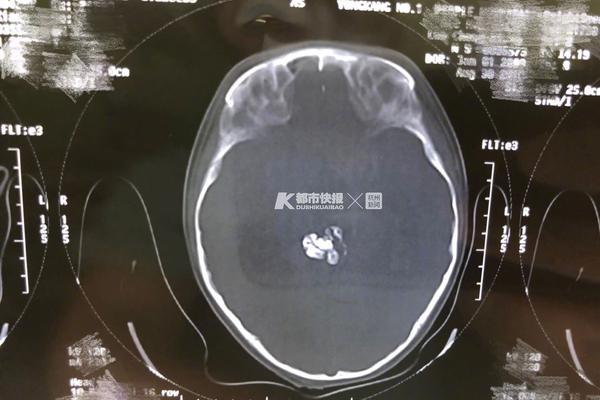 开云app苹果下载-对于职场人来讲，会觉得搞卫生是一种解压方式吗？